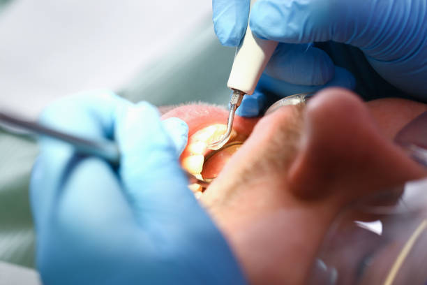 Best Emergency Gum Pain Relief  in Morristown, TN