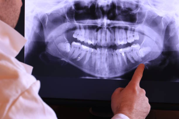 Best Emergency Tooth Extraction  in Morristown, TN